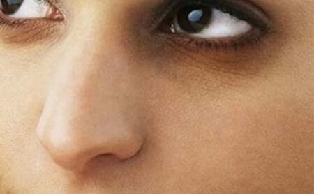 خدمات 51 encyclopedia ما هو علاج الهالات السوداء