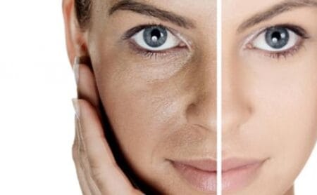 خدمات 49 طريقة علاج كلف الوجه