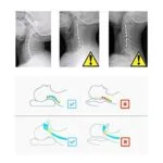 ⁦مخده الفوم الطبيه وساده نوم طبيه⁩ - الصورة ⁦7⁩